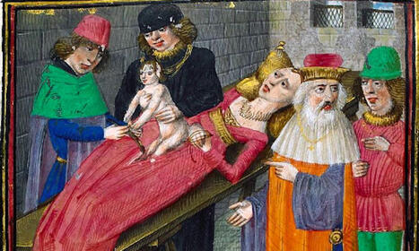 Mist&auml; keisarileikkaus on saanut nimens&auml;? | 1Uutiset - Lukemisen t&auml;hden | Scoop.it