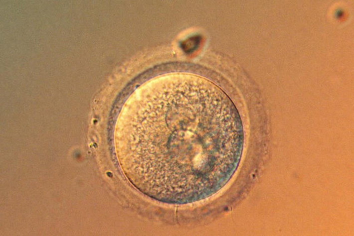 Are we getting to the point where it's safe to gene-edit babies? | The Health Report | Scoop.it