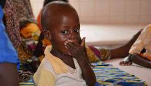 Niger-RDC : deux exemples des ravages de la malnutrition en Afrique | Questions de développement ... | Scoop.it