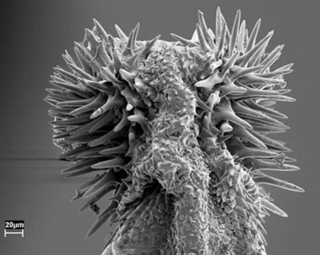 Pourquoi l'homme n'a-t-il plus d'os dans le p&eacute;nis ? : &Eacute;volution des organes g&eacute;nitaux m&acirc;le et femelle et s&eacute;lection sexuelle | EntomoScience | Scoop.it