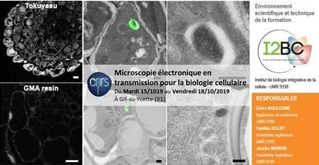 Atelier de microscopie &eacute;lectronique pour la biologie cellulaire - Gif-sur-Yvette - 15 au 18 octobre 2019 | Life Sciences Universit&eacute; Paris-Saclay | Scoop.it