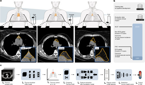 Thymic health consequences in adults - Nature | Jean Daniel Leli&egrave;vre | Immunology | Scoop.it