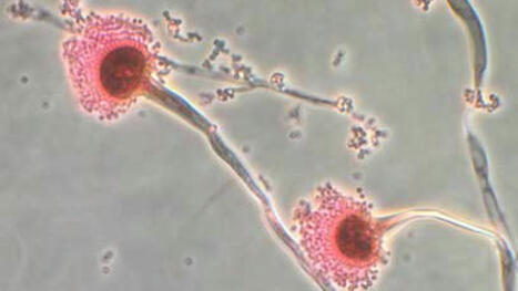 ENVIRONMENT: A fungus that can ‘eat you from the inside out’ could spread as the world heats up | DURABILITES | Scoop.it