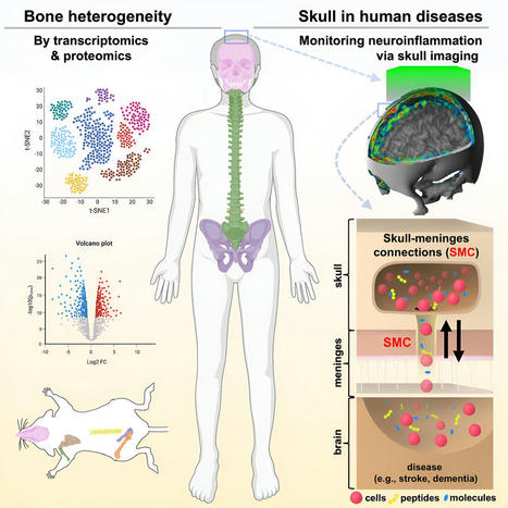 A new ally in fighting brain diseases: Your very own skull | Alzheimer y más (Boletín nº 73) | Scoop.it