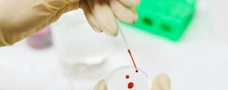 Associations entre les niveaux d’imprégnation sanguine aux polluants organiques persistants et les biomarqueurs de stress oxydatif chez les femmes en France dans les années 90 | Life Sciences Université Paris-Saclay | Scoop.it