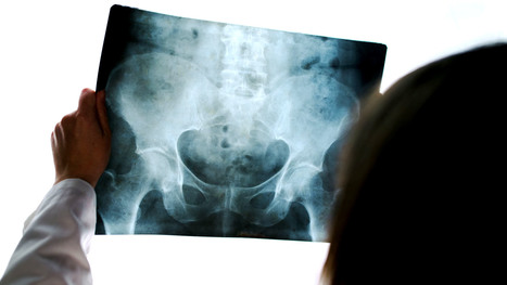 Acute Pelvis & Hip Trauma Imaging Diagnosis Part II | El Paso, TX Chiropractor | Call: 915-850-0900 | Mobility & Flexibility - Joint Movement | Scoop.it