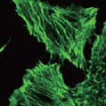 Mutations in KATNB1 Cause Complex Cerebral Malformations by Disrupting Asymmetrically Dividing Neural Progenitors - Neuron | Genetics - GEG Tech top picks | Scoop.it
