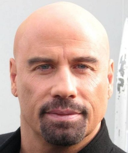Hairstyles For Balding Men What Is It