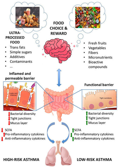 Ultra-Processed Foods Consumption and Asthma in the Western Diet - Dietetics | One Health News: salute, ambiente e societ&agrave; - A cura di ISDE, Festival della salute, Marketing sociale. N&deg;21 | Scoop.it