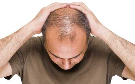 Folliculitis After Hair Transplant Affordable