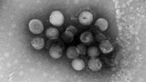 Two More Coronaviruses Can Infect People, Studies Suggest | Virus World | Scoop.it