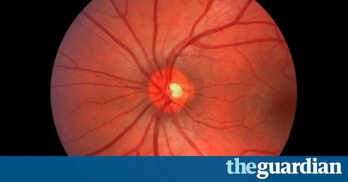 Google DeepMind pairs with NHS to use machine learning to fight blindness | WHY IT MATTERS: Digital Transformation | Scoop.it