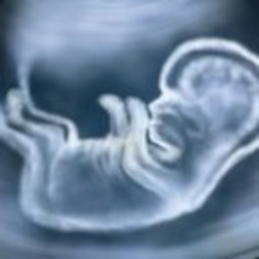 A new autism theory | Kinsanity | Scoop.it