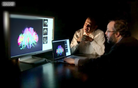 BBC News : "From Massachusetts General Hospital, scans reveal intricate brain wiring | Ce monde à inventer ! | Scoop.it