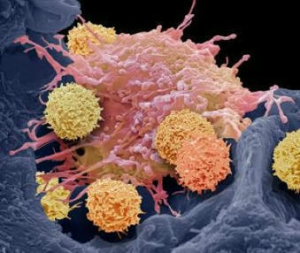 Turbocharged ‘killer’ cells show promise for autoimmune disease Nature | Genetic Engineering Publications - GEG Tech top picks | Scoop.it