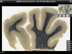 Einstein's brain is now interactive iPad app | Simulation in Health Sciences Education | Scoop.it