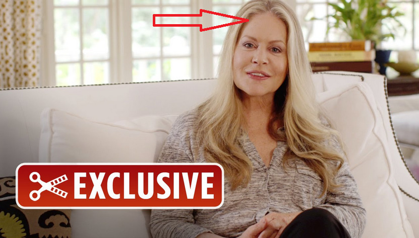 Beverly D Angelo Plastic Surgery Photos | Celeb...