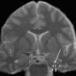 FDA-approved drug rapidly clears amyloid from the brain, reverses Alzheimer's symptoms in mice | 21st Century Innovative Technologies and Developments as also discoveries, curiosity ( insolite)... | Scoop.it