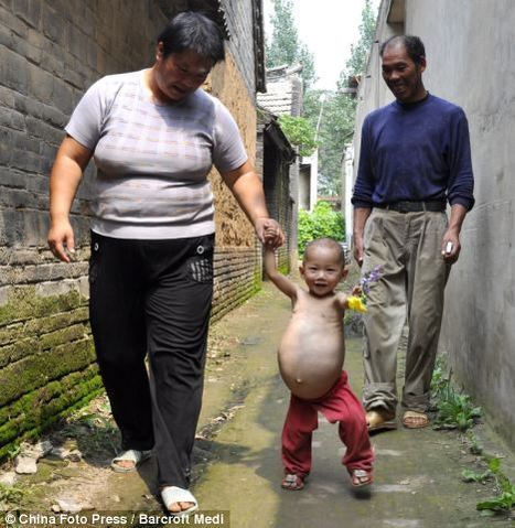 12-Year-Old Chinese Girl Has a Stomach that Won't Stop Growing, Desperate Family Asks for Help | Science News | Scoop.it