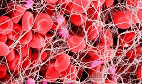 Probabilidad de riesgo de sangrado en terapia anticoagulante | Biblioteca de Alejandro Melo-Florián | Scoop.it