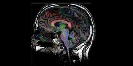 Alzheimer, AVC, dépression… la musique peut-elle remplacer les médicaments ? | Alzheimer, maladies neuro-dégénératives et gérontologie générale | Scoop.it