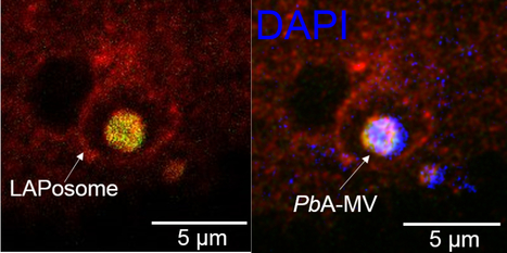 A non-canonical autophagy is involved in the transfer of Plasmodium-microvesicles to astrocytes | I2BC Paris-Saclay | Scoop.it