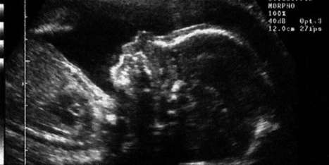 Bébés génétiquement modifiés : de nouvelles propositions d’encadrement | Santé, médecine, sexualité et culture générale | Scoop.it