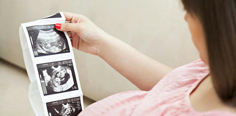 L’exposition à certains produits chimiques pendant la grossesse perturbe le développement du cerveau | Perturbateurs endocriniens | Scoop.it