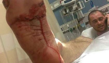 Shark bites surfer near Cocoa Beach Pier | Soggy Science | Scoop.it