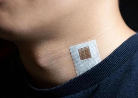 AVC : Le patch cutané qui annonce l’accident | Actualité sanitaire et sociale - CRDI Croix-Rouge Compétence                               Hauts-de-France | Scoop.it