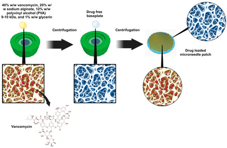 Sodium Alginate Microneedles Loaded with Vancomycin for Skin Infections | Intra-Dermal drug delivery: Opportunities and Challenges? | Scoop.it