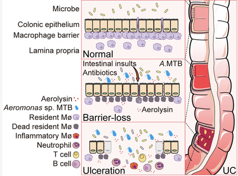 An Aeromonas variant that produces aerolysin promotes susceptibility to ulcerative colitis | sci | RMH | Scoop.it