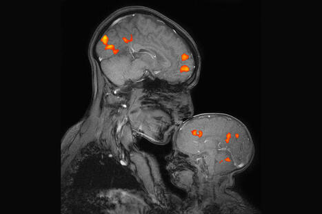 MIT’s McGovern Institute is shaping brain science and improving human lives on a global scale | Technology | Scoop.it