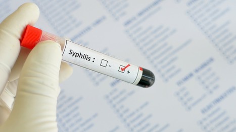 IST : la résistance aux antibiotiques inquiète | sida | Scoop.it