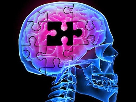 Alzheimer, un « raz-de-marée » qui inquiète l’OMS | Koter Info - La Gazette de LLN-WSL-UCL | Scoop.it