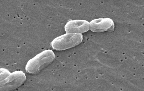 Les bact&eacute;ries communiquent leur r&eacute;sistance aux antibiotiques | Microbiologie | Scoop.it