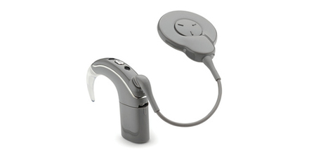 Nouvelles fonctionnalités pour le Nucleus 7 de Cochlear | Revue de presse Implant Cochléaire | Scoop.it
