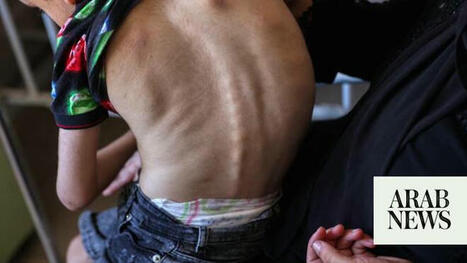 MALNUTRITION in Gaza could rise exponentially, UNRWA official says | CIHEAM Press Review | Scoop.it