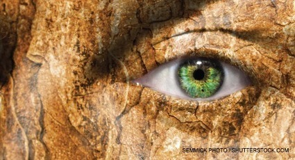 Diffuse Scleroderma: A 1991 Case Through the Lens of Today | AUTOIMMUNITY | Scoop.it