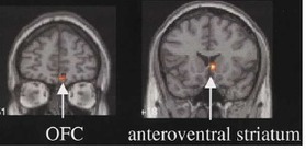 8 estrategias basadas en el funcionamiento del cerebro ~#Neuroeducación | NeuroPsicoEducación al Día | Scoop.it