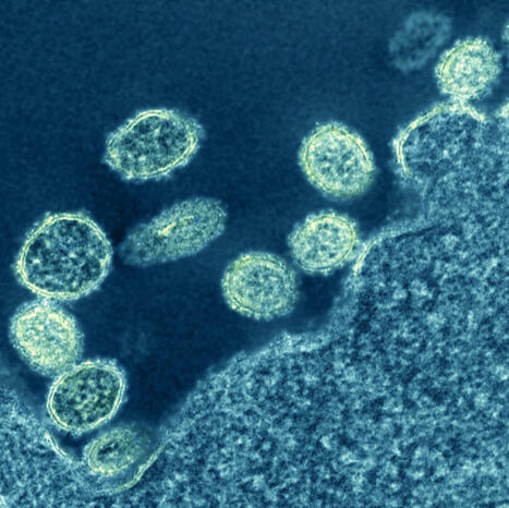 Delhi Faces Surge in H1N1 and Dengue Cases | Virology News | Scoop.it