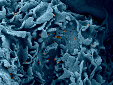 Plusieurs formes &laquo; d&rsquo;orages cytokiniques &raquo; sont associ&eacute;s &agrave; la s&eacute;v&eacute;rit&eacute; et la mortalit&eacute; dans la Covid-19 | Immunology | Scoop.it
