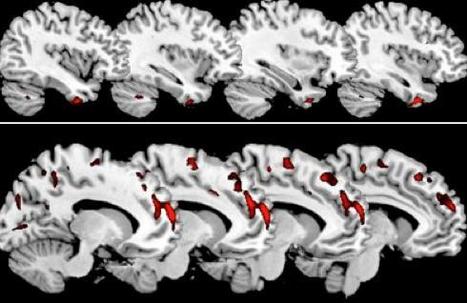 Psychopathy linked to specific structural abnormalities in the brain | Science News | Scoop.it