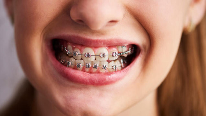 Why our ancestors had straight teeth without braces | The Health Report | Scoop.it
