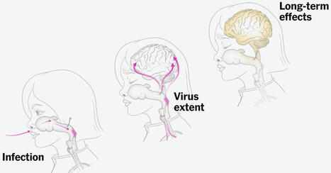 How Measles Attacks an Unvaccinated Child. | eParenting and Parenting in the 21st Century | Scoop.it
