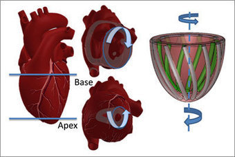 Artificial muscles that do the twist - Nanowerk | Biomimicry 3.8 | Scoop.it