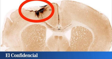 Hacen un experimento con ratones y consiguen revertir los síntomas del alzhéimer de forma "simple, segura y eficaz" | Alzheimer y más (Boletín nº 78) | Scoop.it