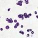 Peanut in household dust linked to peanut allergy in children with eczema ... - Medical Xpress | Allergy (and clinical immunology) | Scoop.it