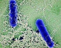 [Actualit&eacute; - Septembre 2011] R&eacute;sum&eacute; des liens sur les cas de Botulisme d&eacute;tect&eacute;s dans le Vaucluse | Microbiologie | Scoop.it