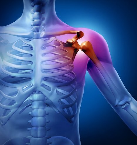 Types of Shoulder Fractures | Sports Injuries | Scoop.it